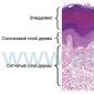 Строение дермы кожи человека